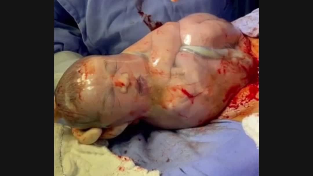 PicsArt_12-11-10.31.14 PicsArt_12-11-10.31.14