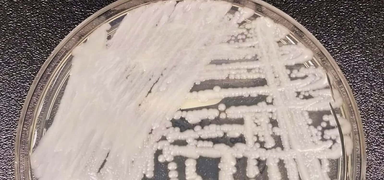 Foto: CDC / Dr. Leanor Hailey