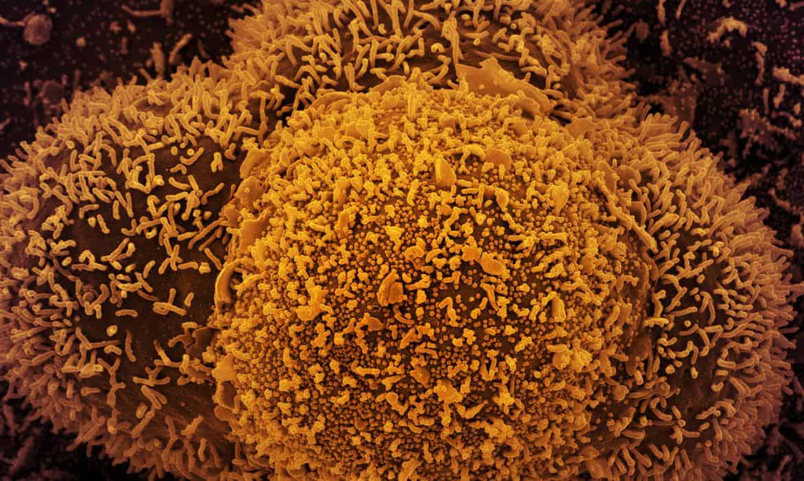 50853314272_fa477f4341_o Foto: NIAID