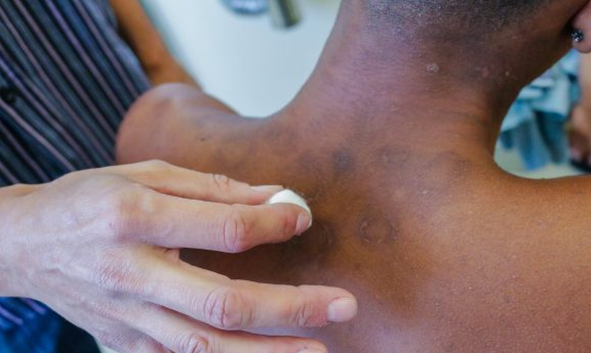 92c423d1-9dc3-47c0-8069-51b6f1f6de8a 92c423d1-9dc3-47c0-8069-51b6f1f6de8a