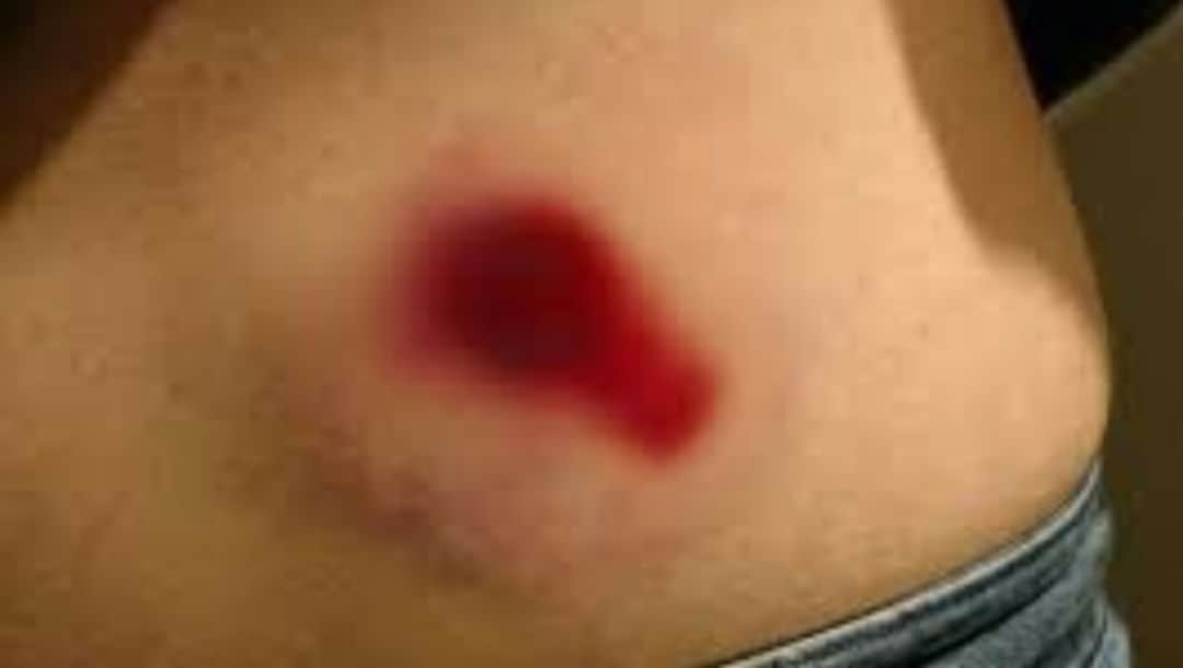 Screenshot_20220102-110749_Gallery_1