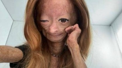 crop-4-418×235 crop-4-418x235