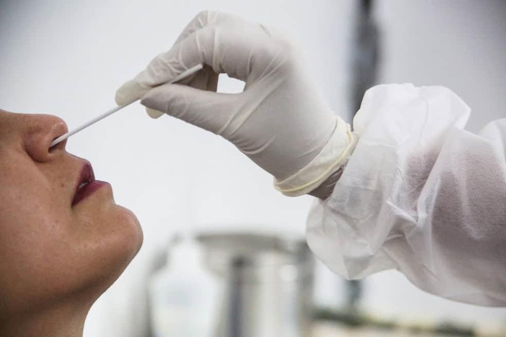 teste-covid-1 teste-covid-1