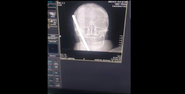 sem-titulo sem-titulo