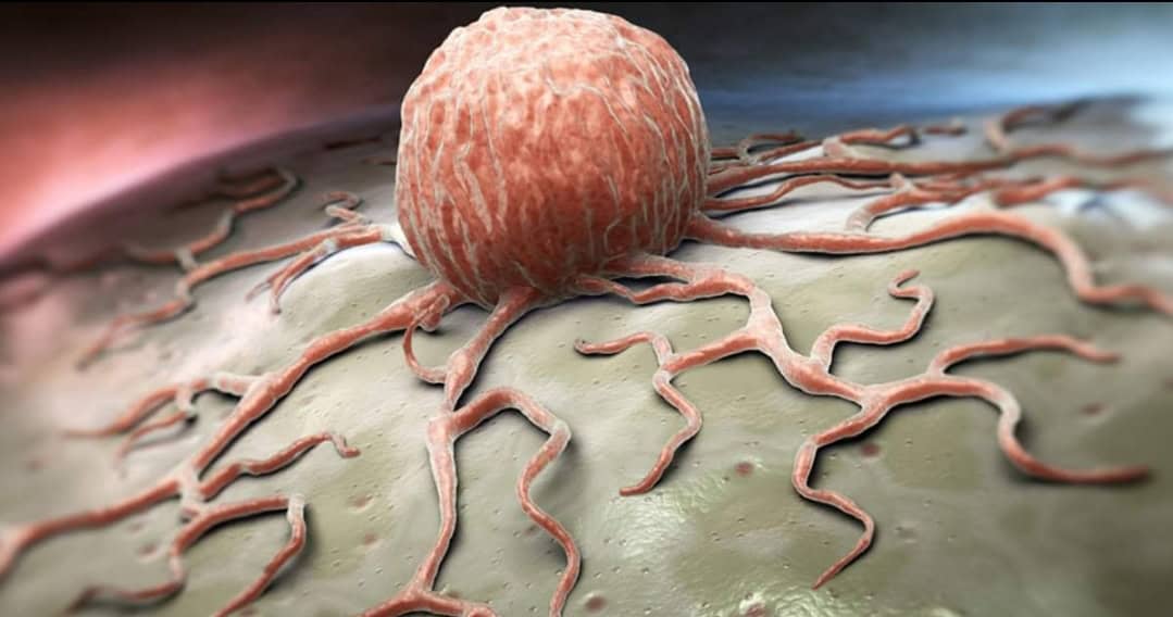 Screenshot_20220616-082456_Facebook Screenshot_20220616-082456_Facebook