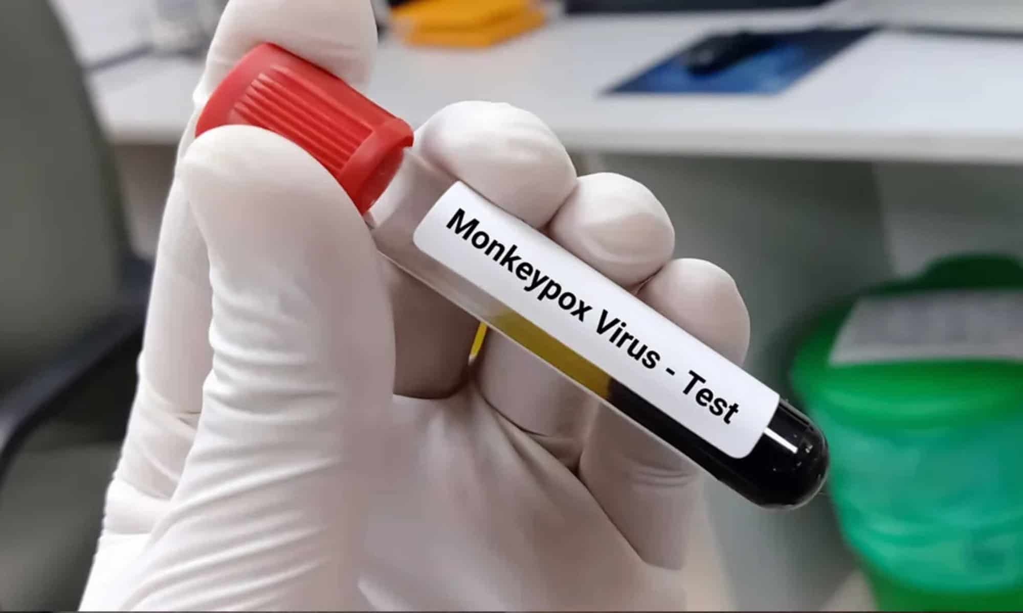 Esse tipo de complicação também já é relatado em casos de outros vírus da mesma família do monkeypox. Foto: reprodução