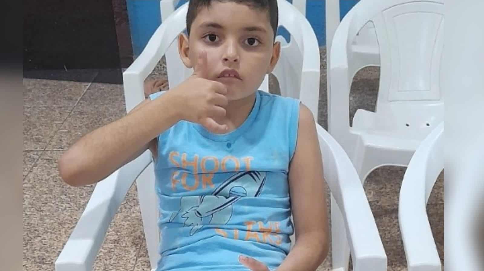 IMG-20220721-WA0147 Menino do AC sofre queimaduras de 3º após descarga elétrica é e transferido para hospital em Goiânia — Foto: Arquivo pessoal