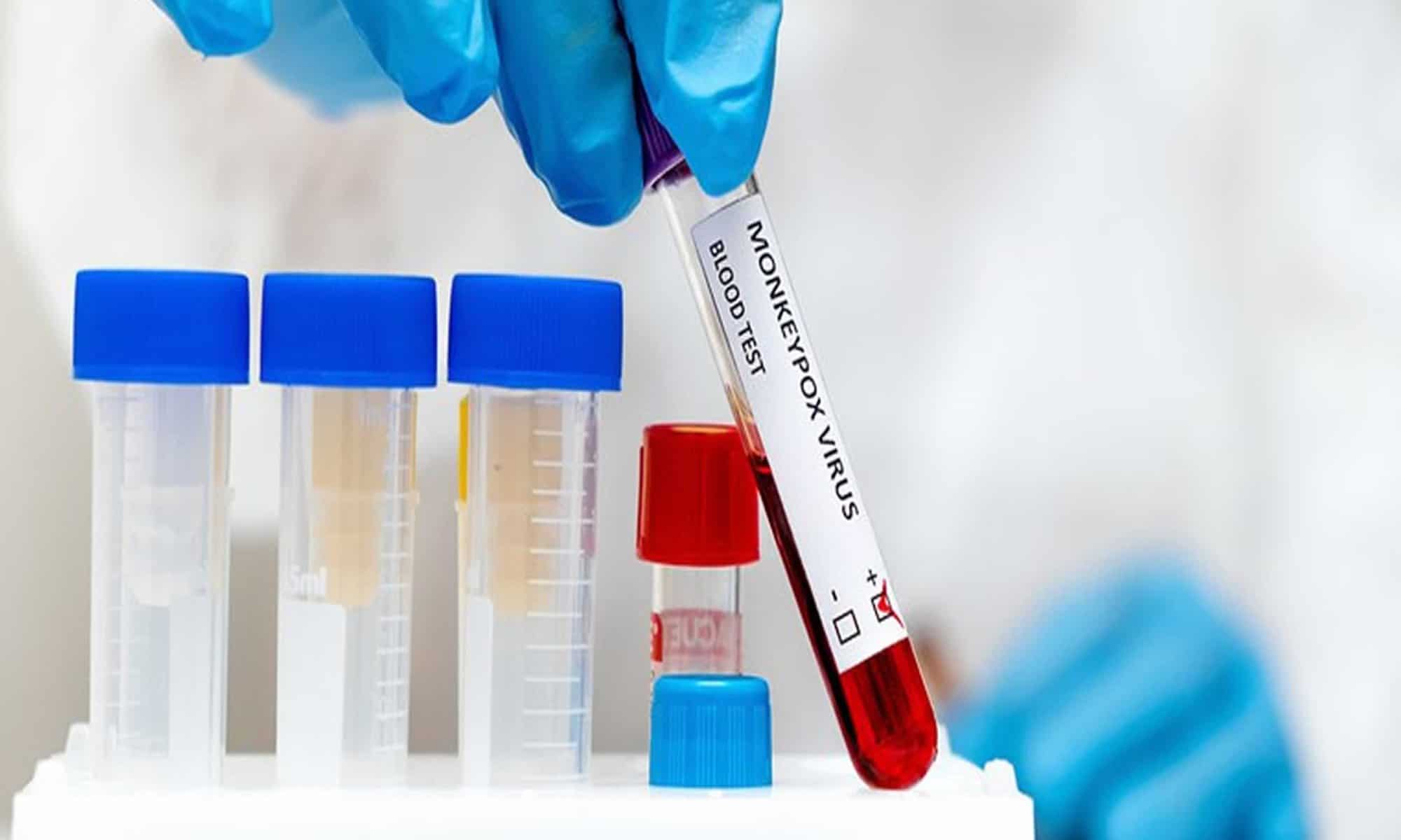 03 Serão contemplados casos mais graves em um primeiro momento. Foto: reprodução