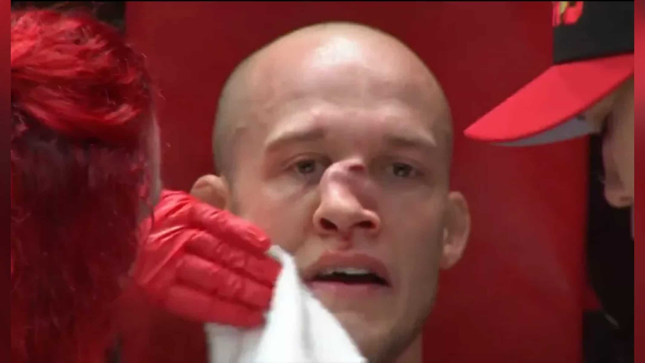 O nariz quebrado de Blake Perry em luta no A1 Combat 4 — Foto: Reprodução/Twitter