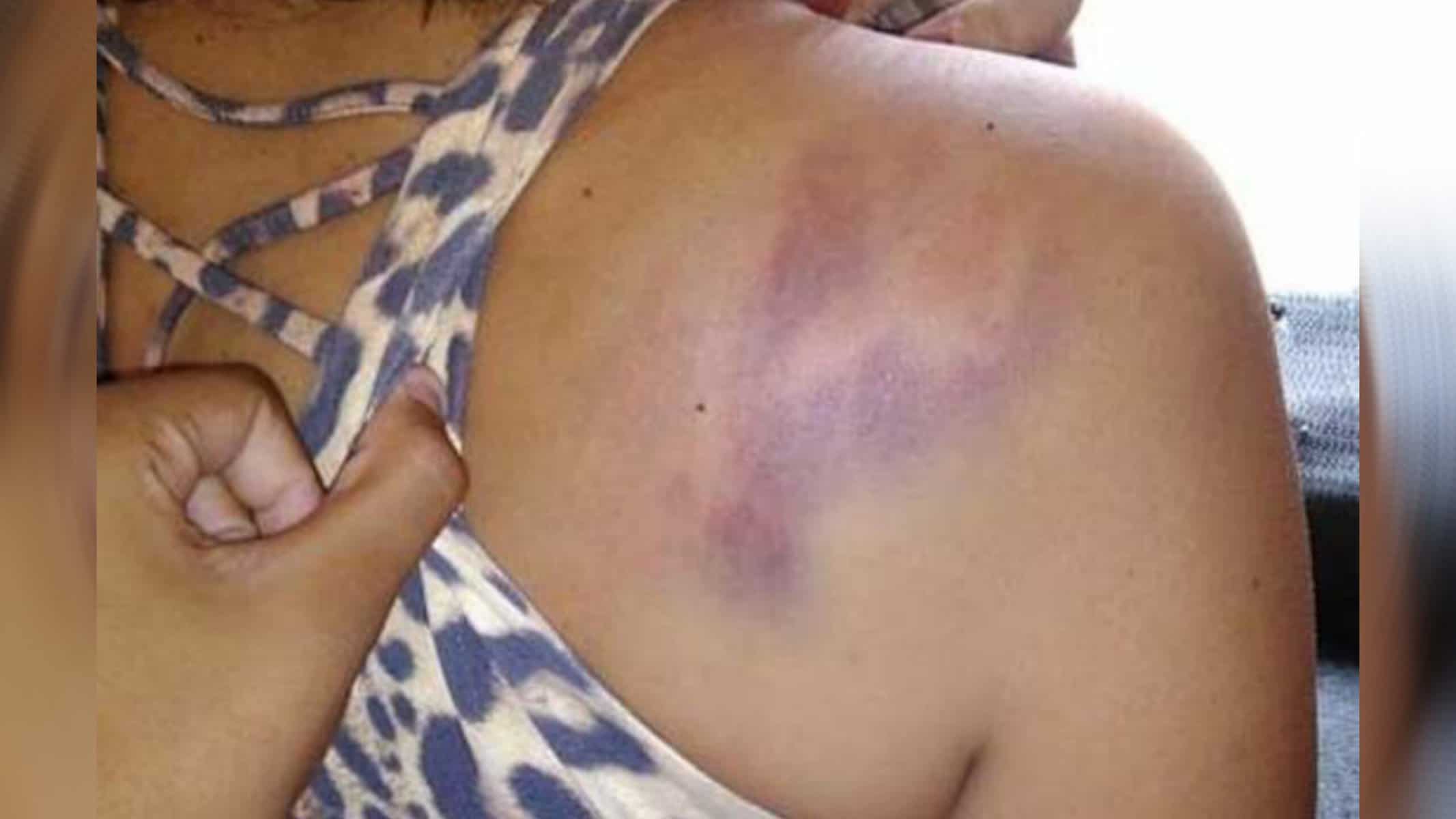 Picsart_22-08-08_15-27-52-835 Foto: ILUSTRATIVA