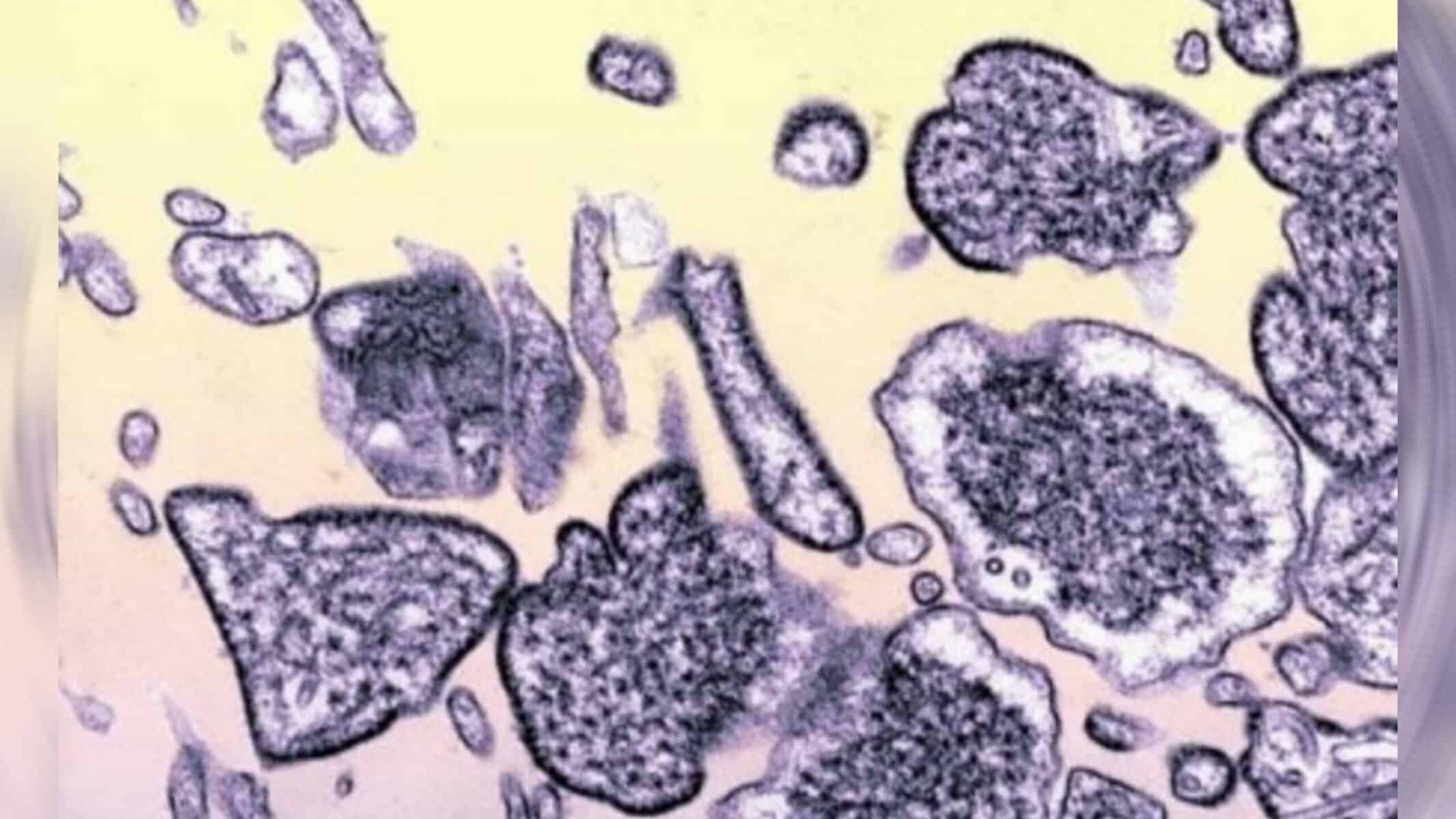 Picsart_22-08-09_18-02-46-615