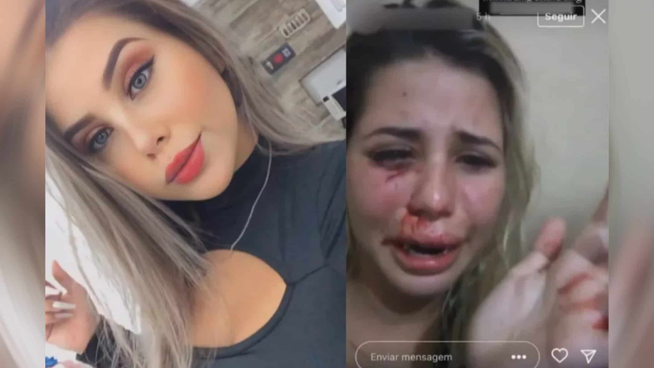 Picsart_22-08-12_17-45-22-827 Modelo e influenciadora digital Amanda Souza gravou vídeo machucada e postou nos stories do Instagram — Foto: Reprodução/ Instagram