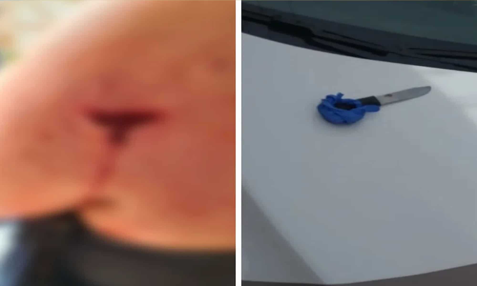 11 Vítima foi esfaqueada ao sair do veículo — Foto: PM/ Divulgação