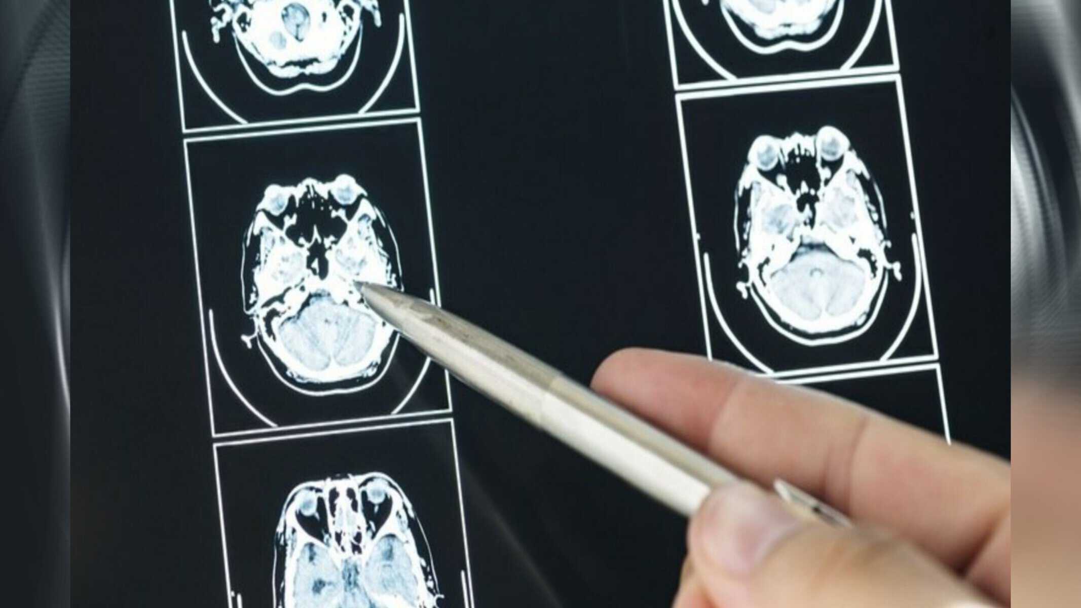 Picsart_22-09-05_17-33-56-765 (Foto: Divulgação – Freepik)