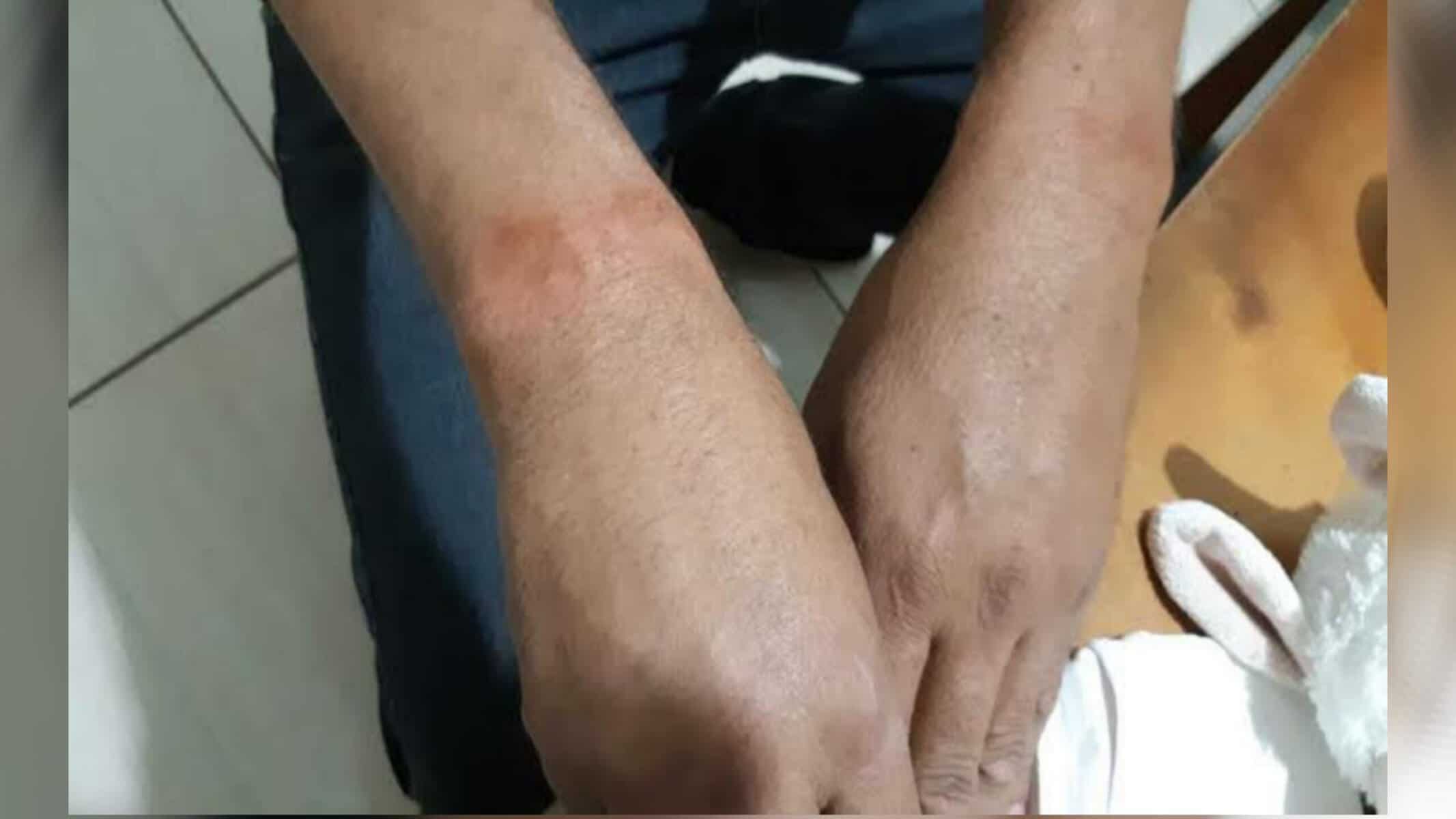 Picsart_22-09-06_19-12-16-157 Foto: IKUSTRATIVA