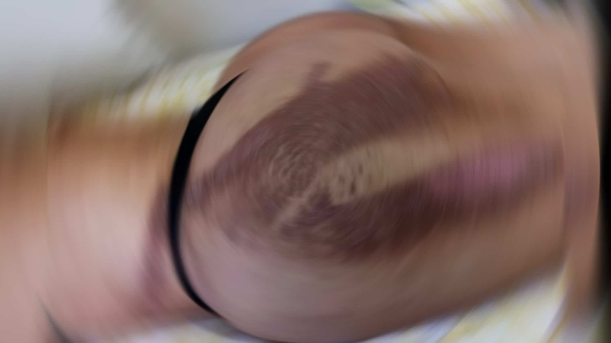 Além das queimaduras, Danny Albuquerque teve dor de cabeça, náuseas e confusão mental — Foto: Arquivo pessoal