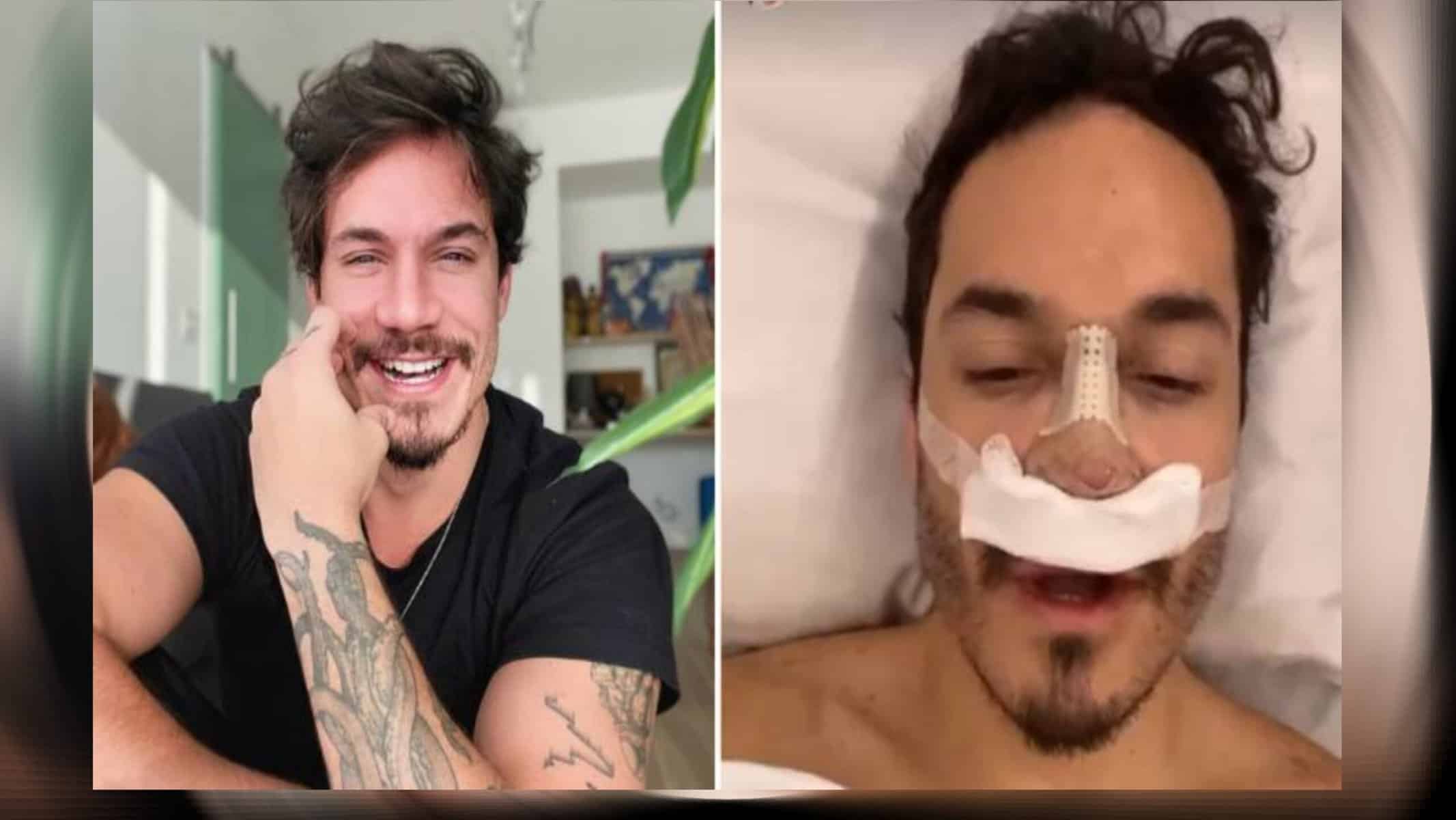 Picsart_22-09-28_19-02-35-034 Eliezer passa por rinoplastia
REPRODUÇÃO/INSTAGRAM
