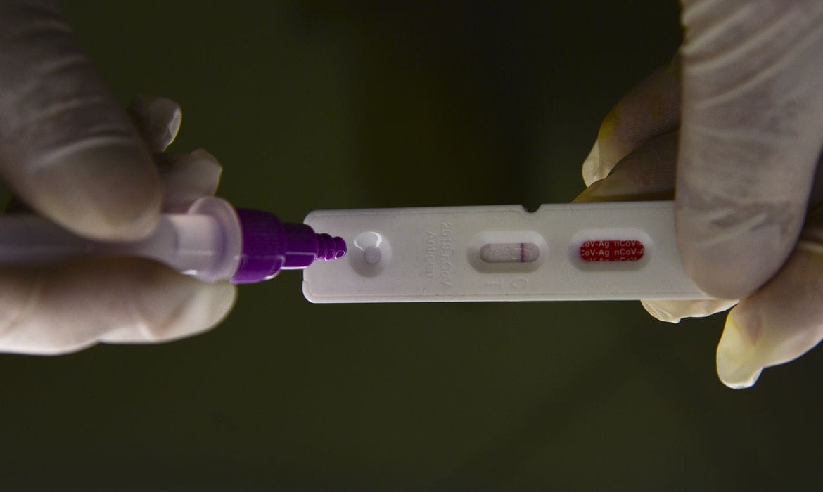 Teste Rápido Antígeno para Covid-19 Teste Rápido Antígeno para Covid-19
