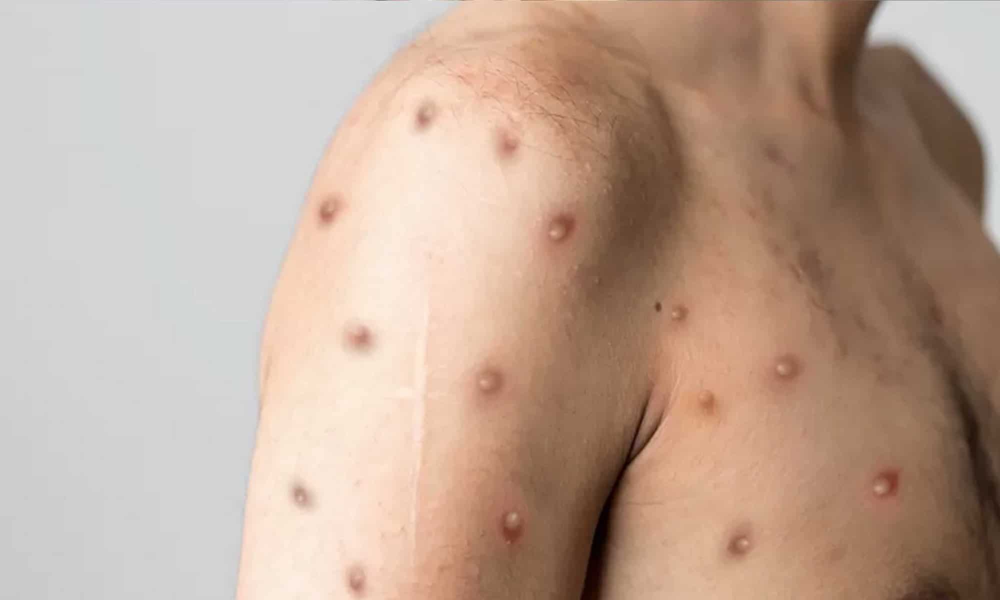 11 Foto: reprodução