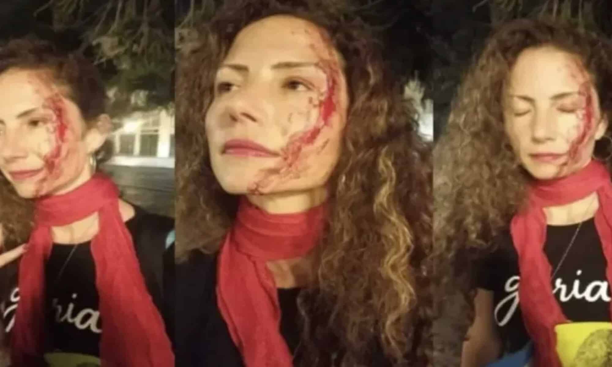 12 Jornalista com adesivo do Lula é espancada em Curitiba. Foto: Reprodução.