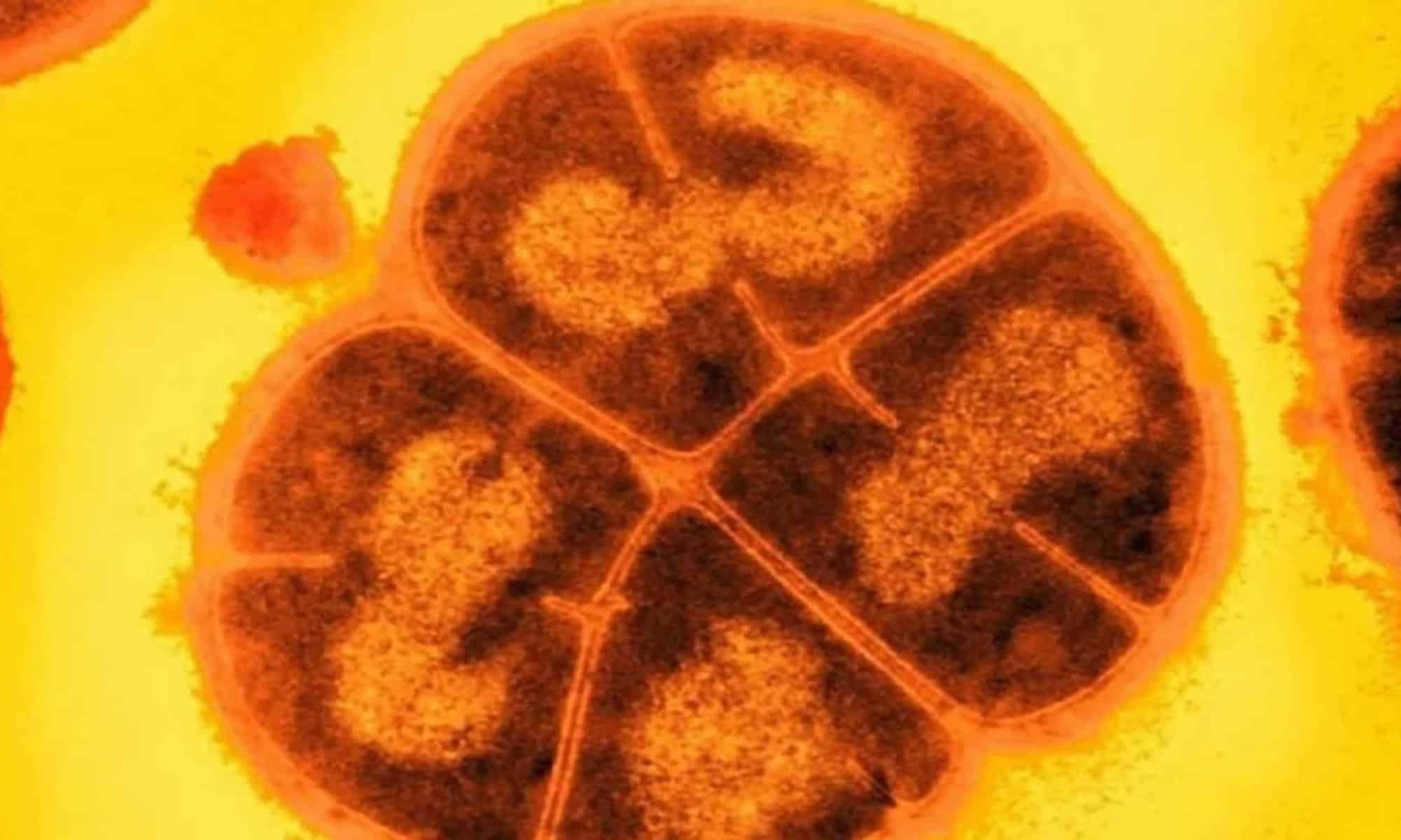 17 Imagem: Michael J. Daly/USU/Divulgação