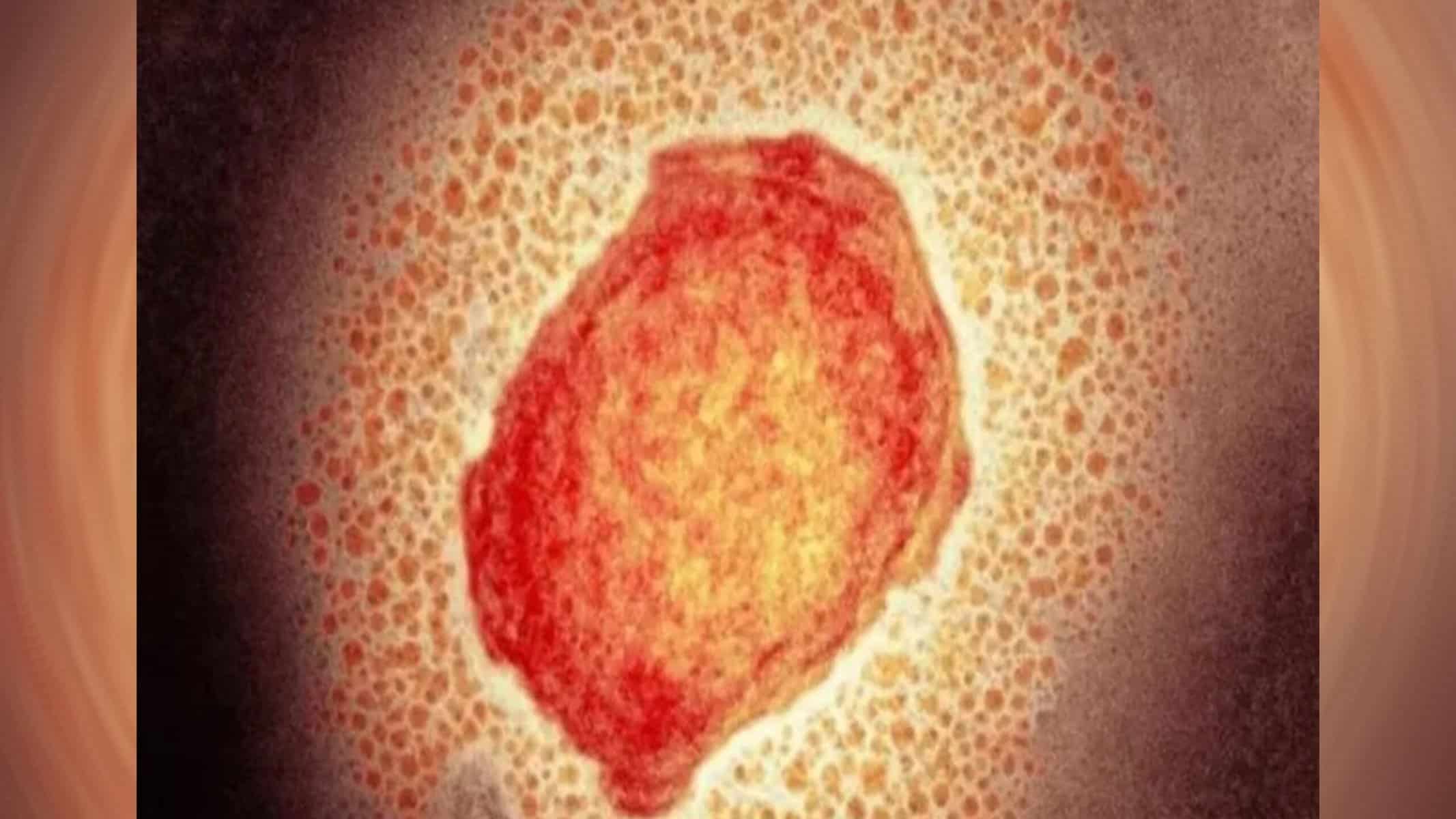 Acre notifica mais um caso suspeito de varíola dos macacos — Foto: SCIENCE PHOTO LIBRARY/BBC