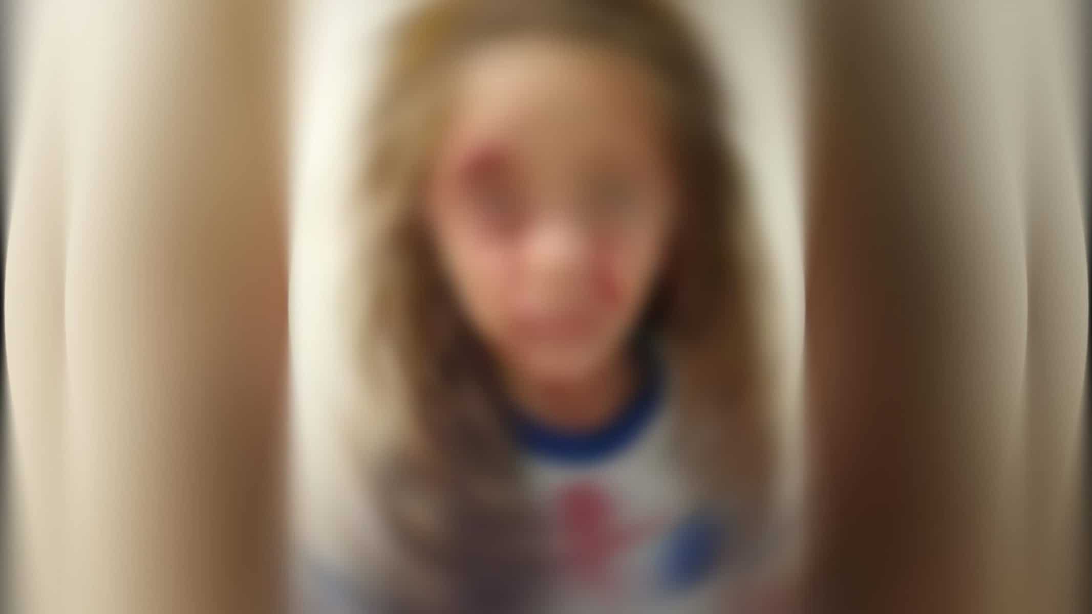 Menina ficou bastante machucada — Foto: Reprodução