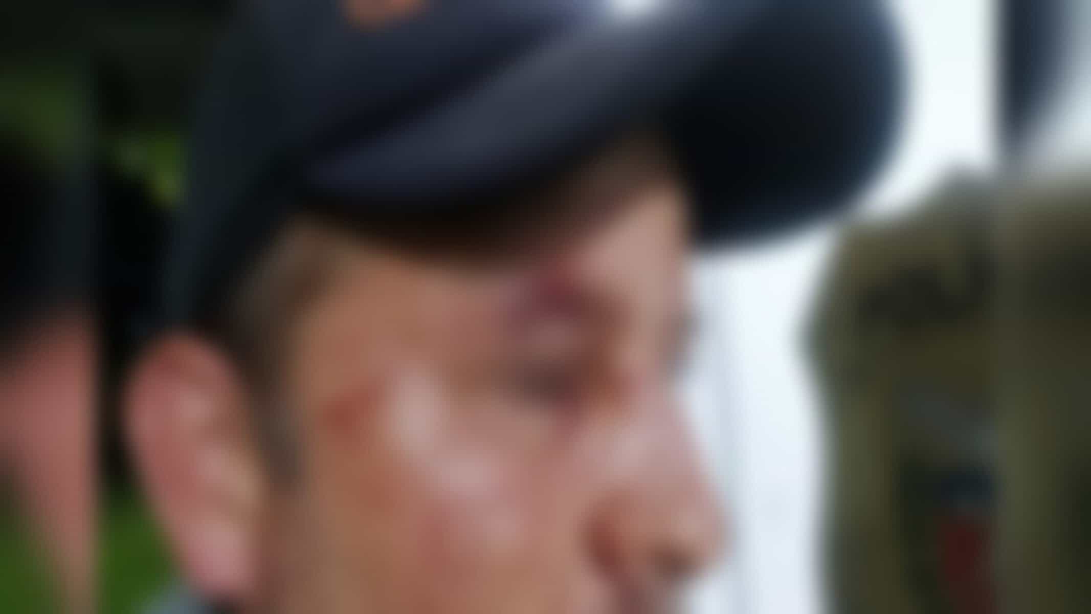 O pai quis mostrar as agressões que sofreu – Foto: Cristiano Vaz/Banda B.