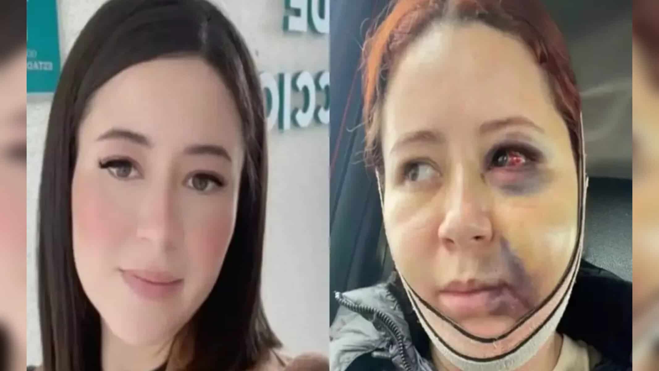 VÍDEO: mulher faz procedimento estético e sofre derrame (Foto: Reprodução / redes sociais)