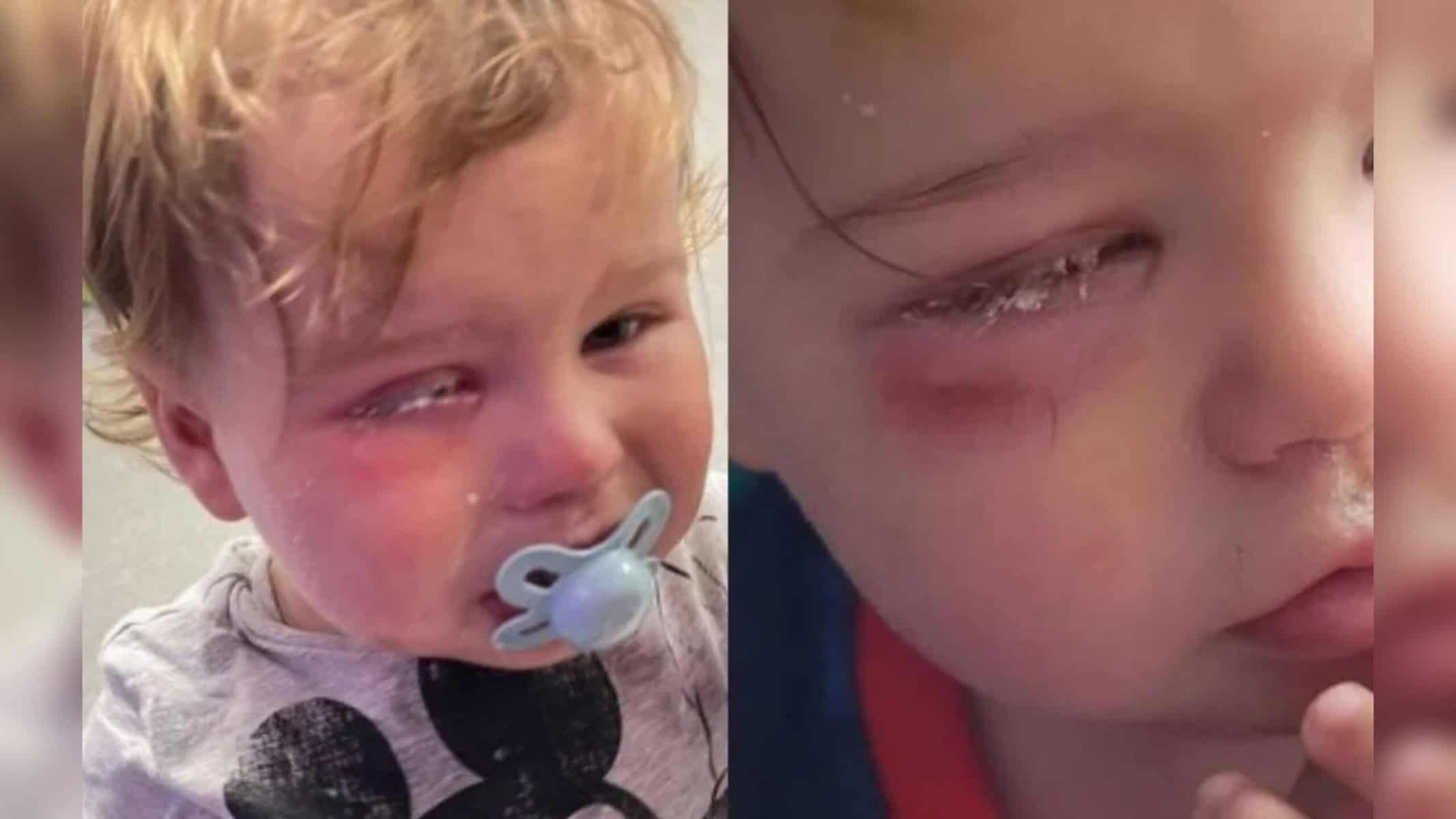 Picsart_22-10-20_15-31-36-004 Felizmente, a visão do bebê não foi prejudicada