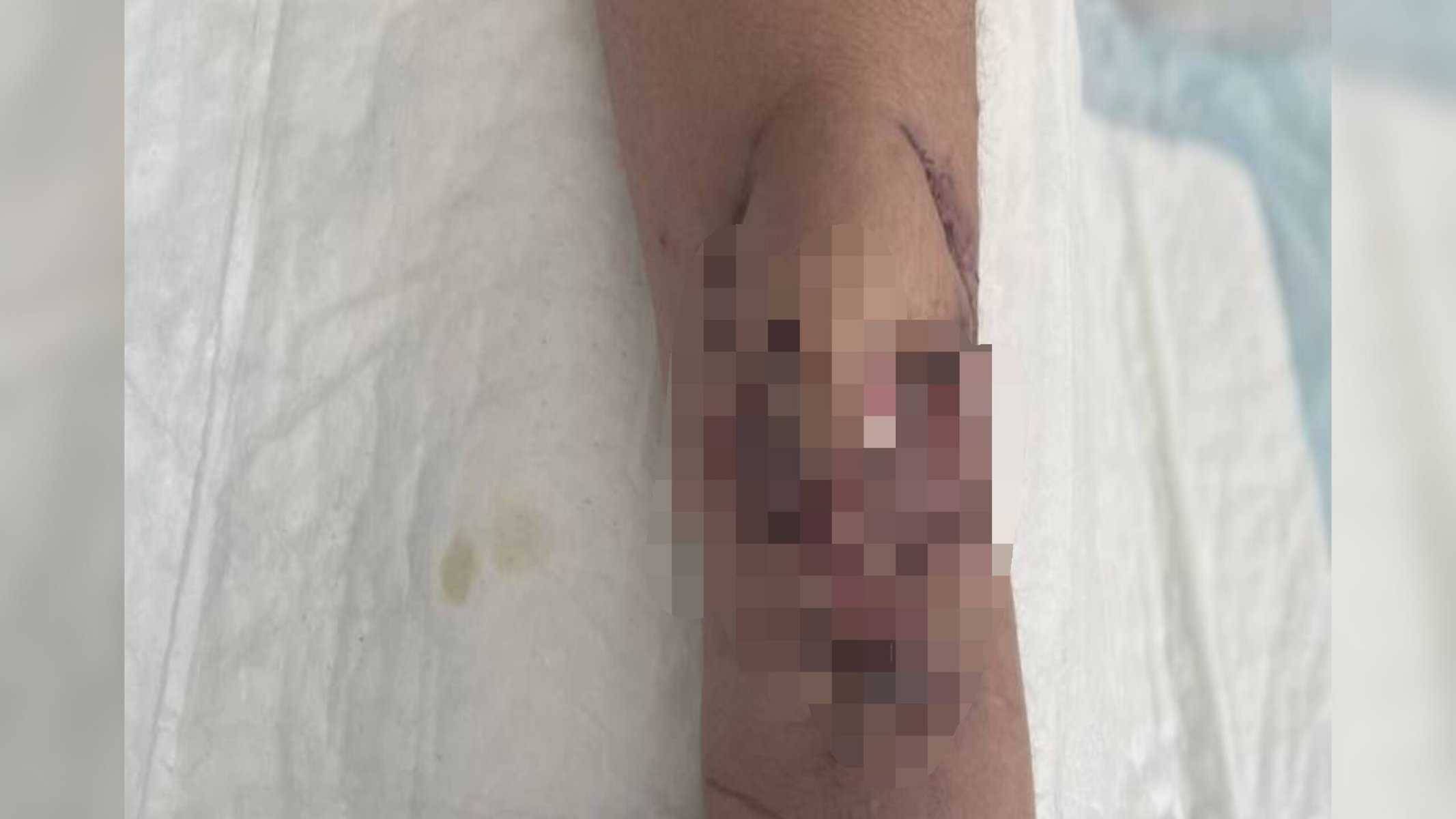 Foto: Reprodução/Chu de Toulouse