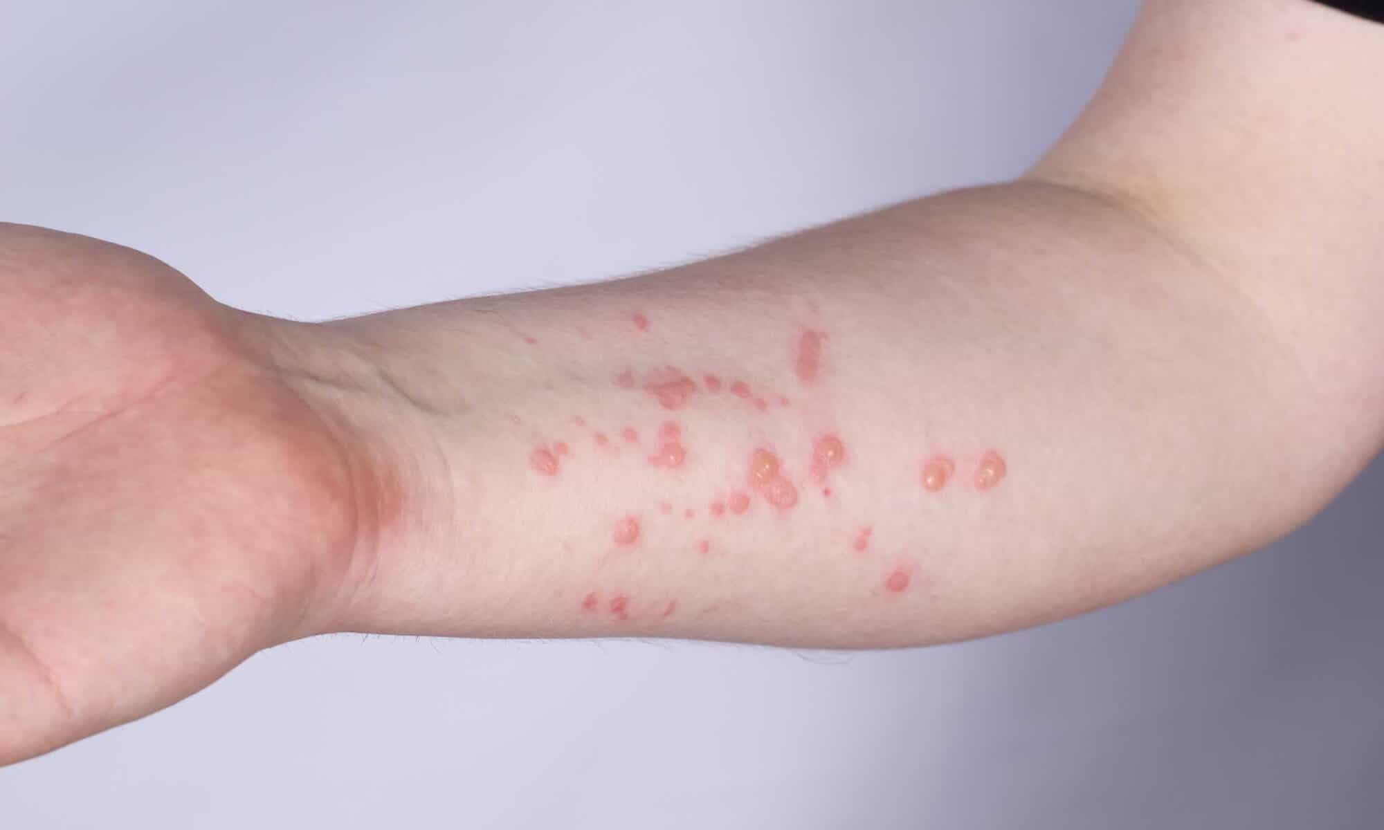 15 Foto: reprodução