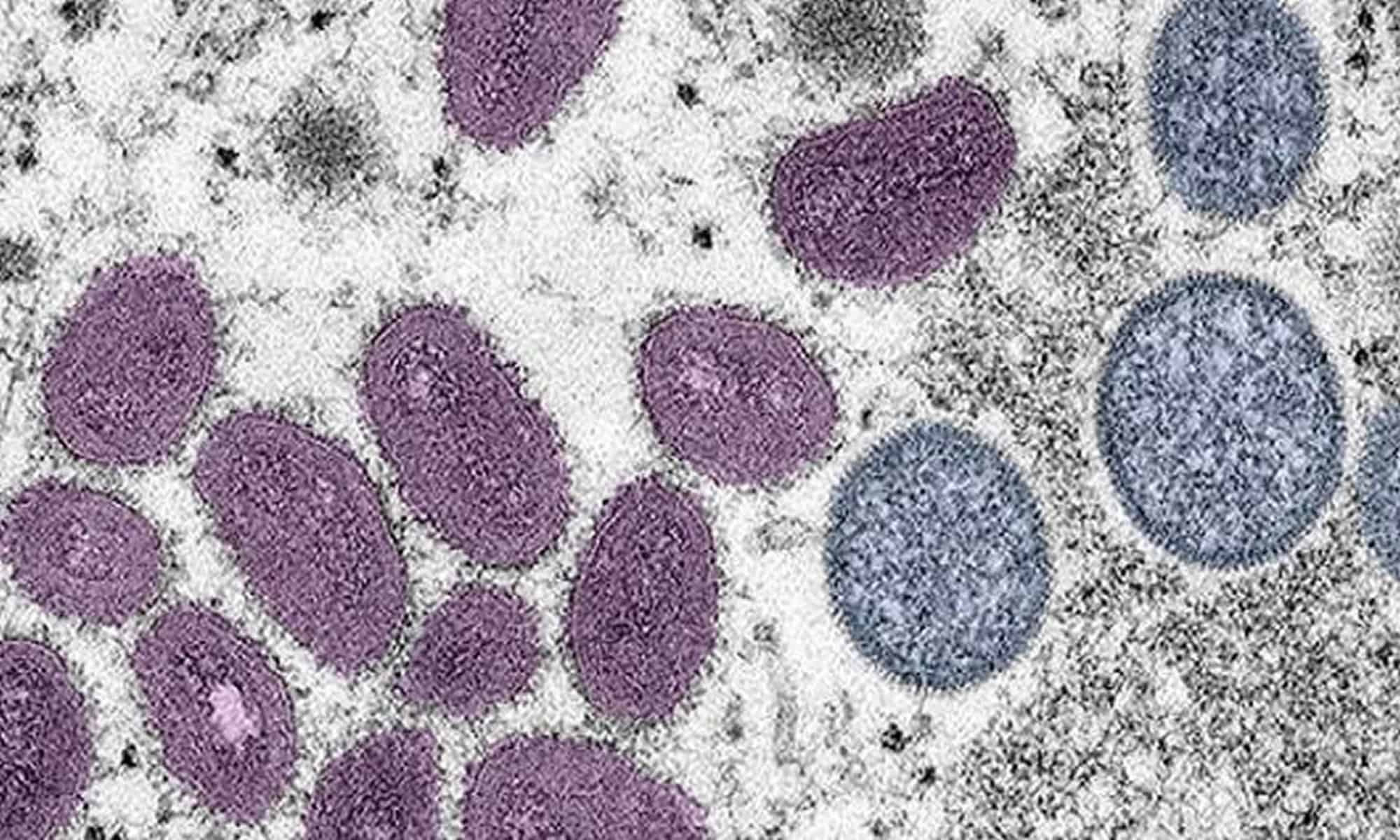 16 Imagem: ilustrativa