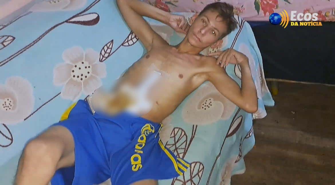 Imagem do WhatsApp de 2022-12-14 à(s) 22.16.53 Foto: Otávio Damasceno/Ecos da Notícia