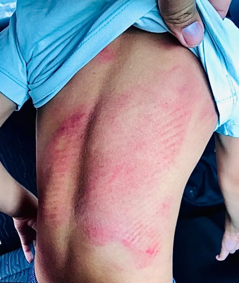 whatsapp-image-2022-12-08-at-09.50.15 Crianças resgatadas estavam com marcas de agressão por cinturão nas costas, peito e braços — Foto: Arquivo/Polícia Civil