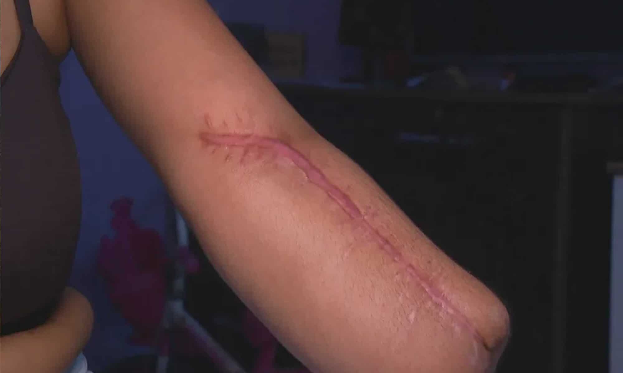 12 Foto: reprodução