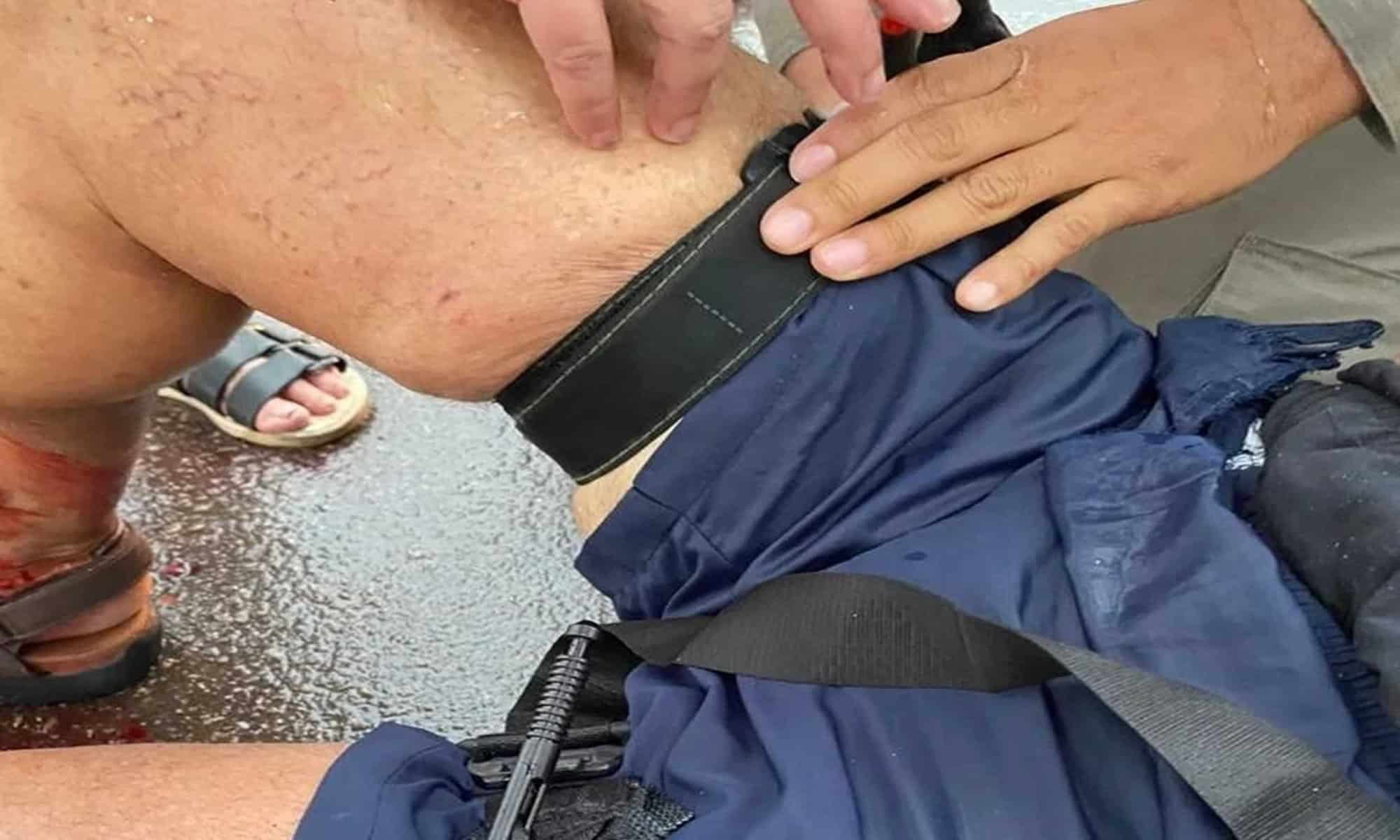 15 O idoso teve fratura nas duas pernas e muito sangramento. Foto: cedida