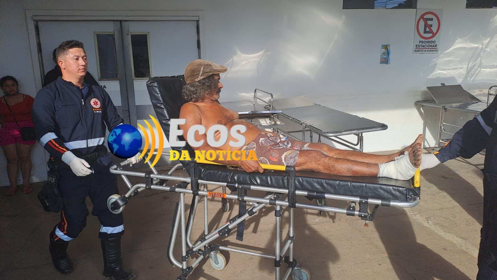 Idoso tem planta do pé arrancada em acidente de trânsito