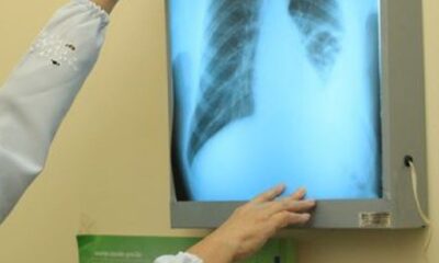 WhatsApp Image 2023-04-18 at 11.10.18 WhatsApp Image 2023-04-18 at 11.10.18