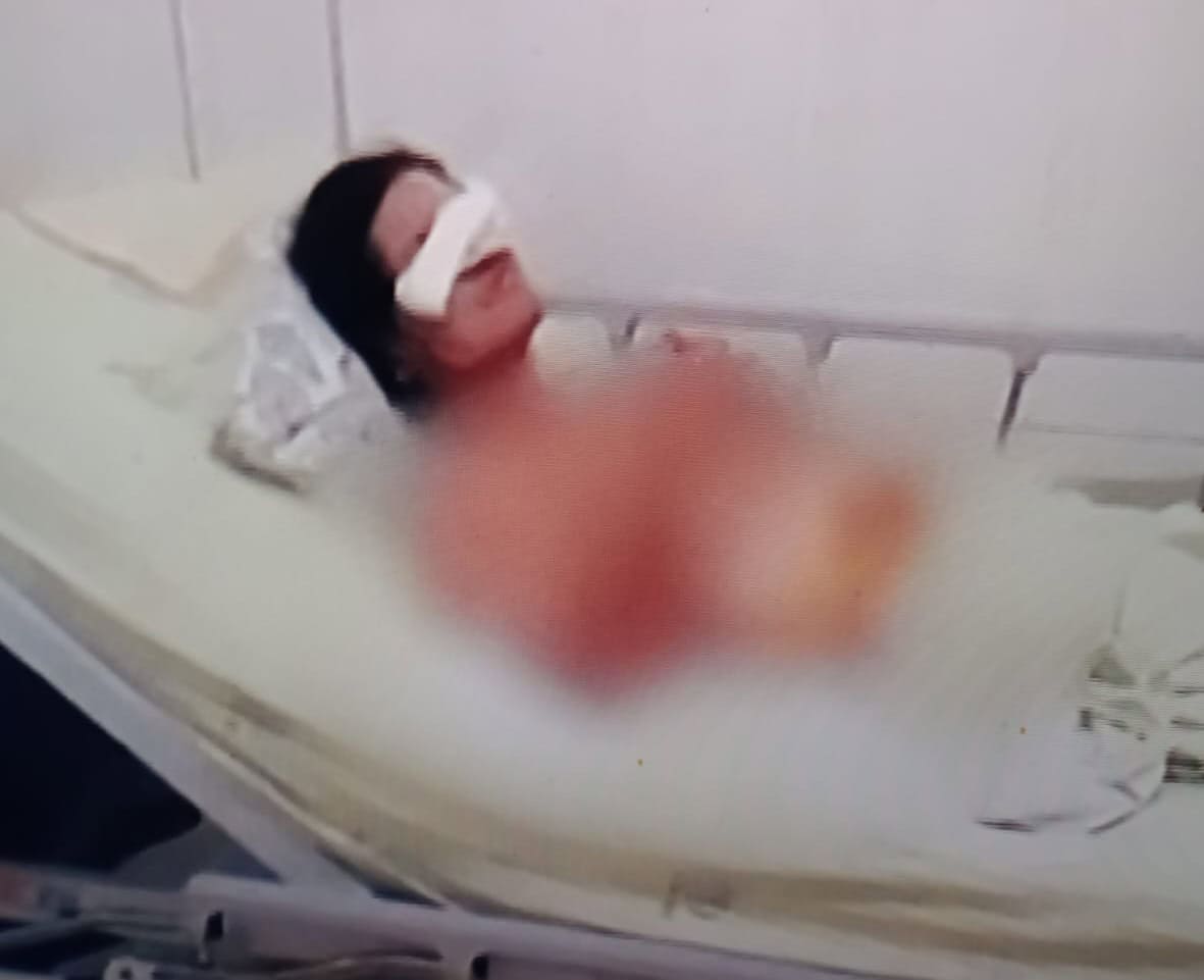 Família de vítima de assalto diz que homem ficou com vísceras expostas após cirurgia