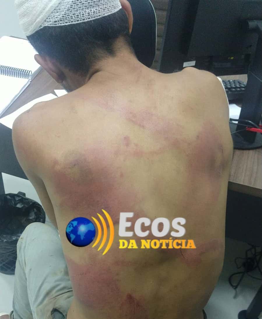Acusado de bater na esposa é agredido por facção e obrigado a se entregar em delegacia no Acre