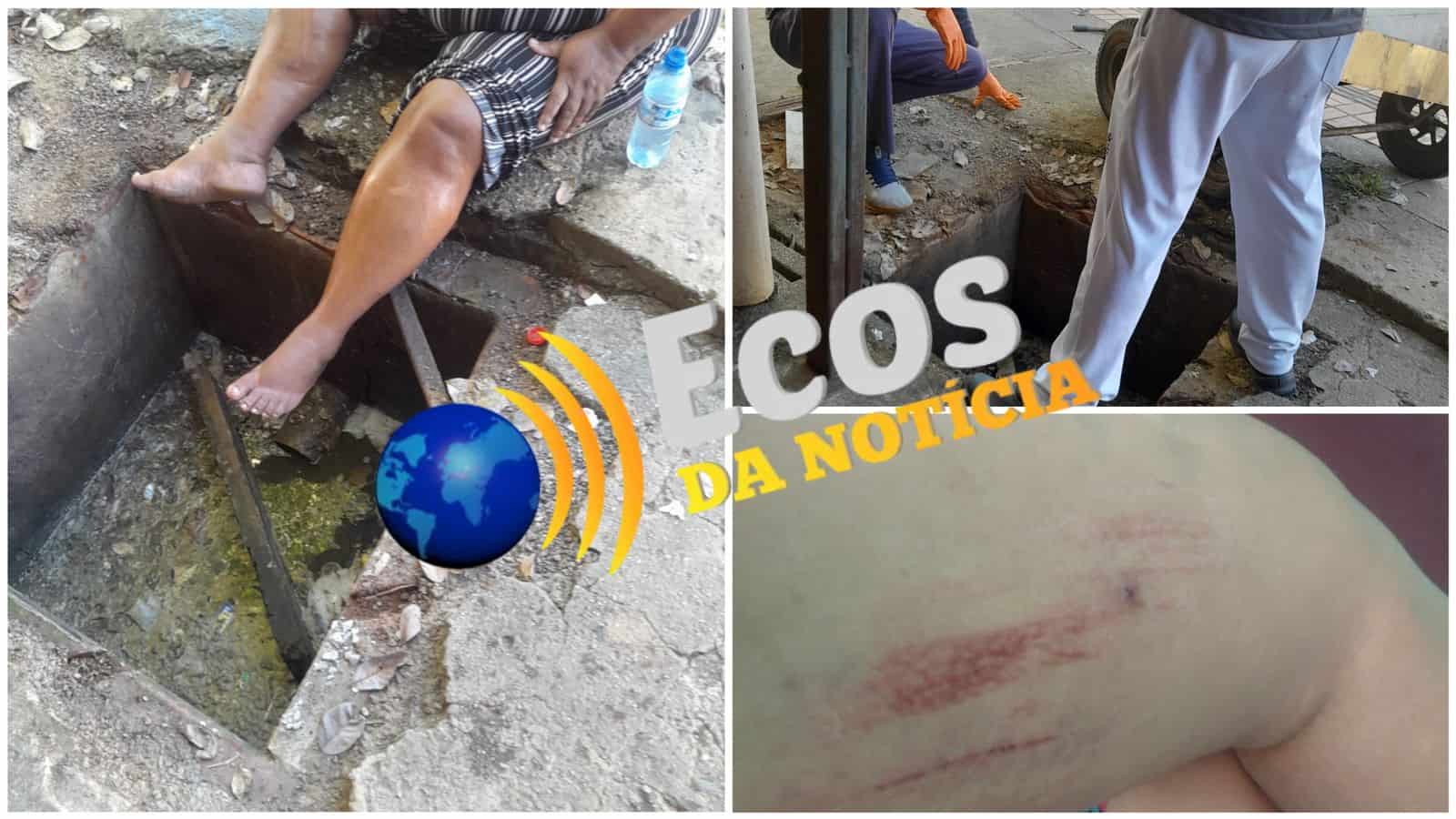 Mulher pisa em tampa de bueiro solta da Fundação Hospitalar e cai em buraco