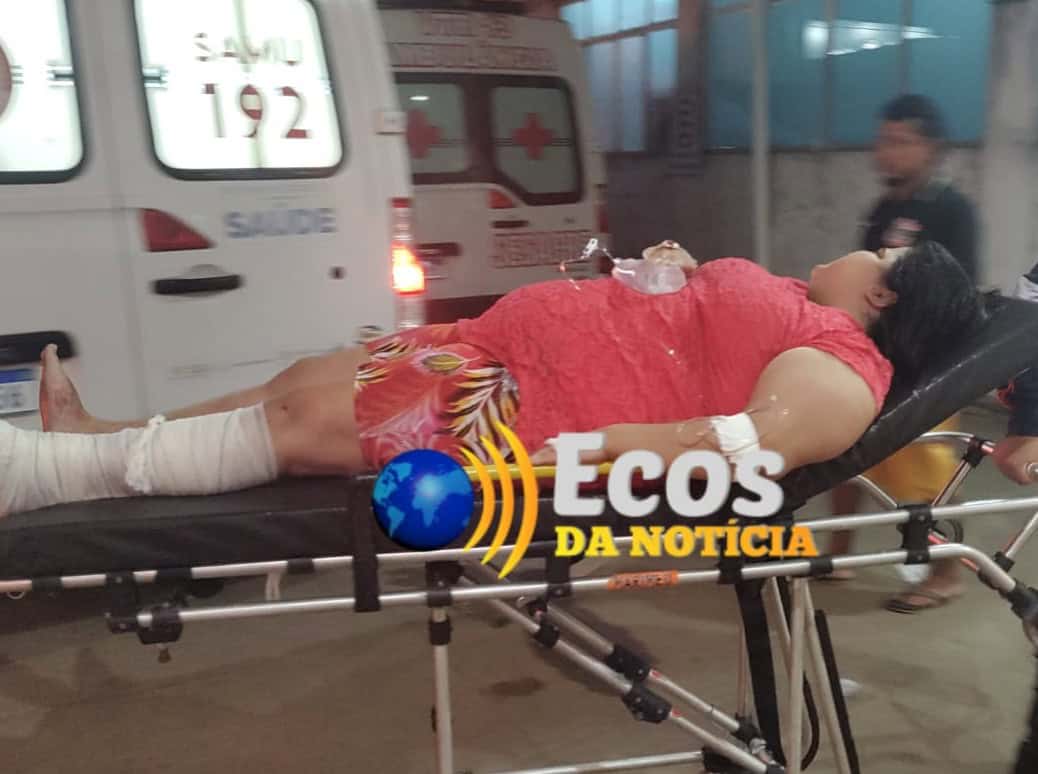 Mulher sofre fratura na perna ao cair com motocicleta em buraco na estrada da Transacreana