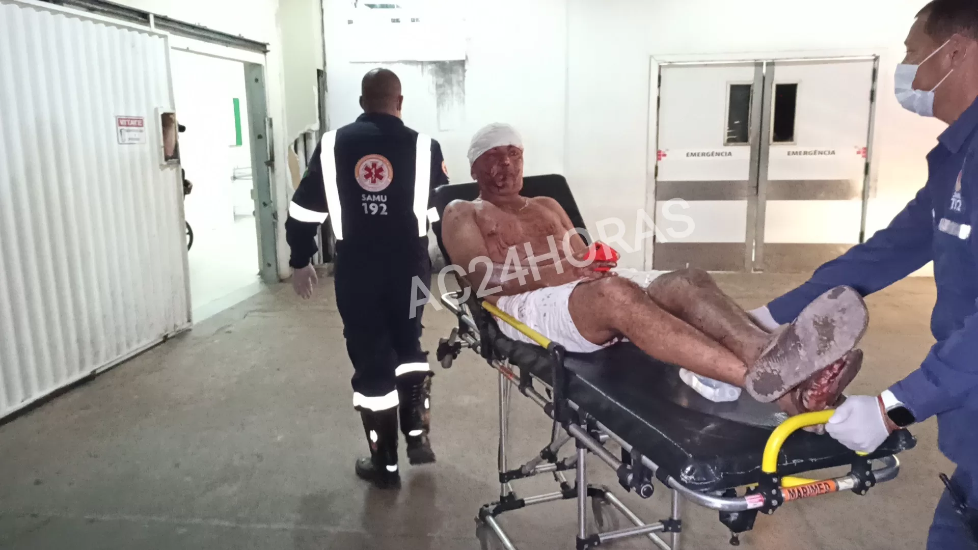 Sogro vai tirar satisfação por genro maltratar sua filha e recebe duas terçadada no bairro Aviário