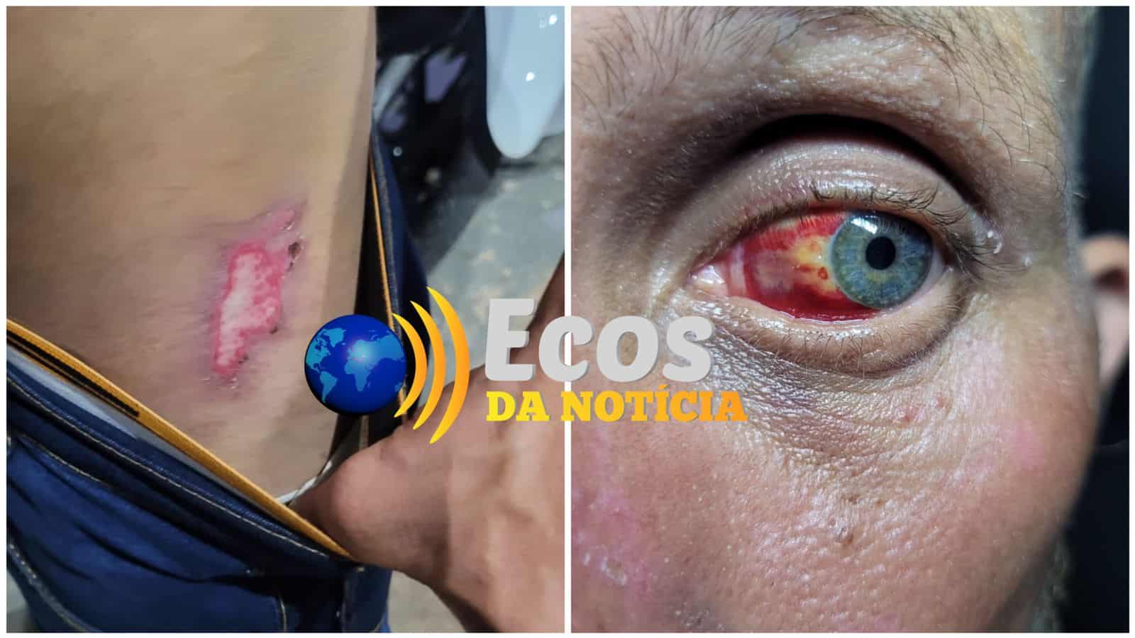 No Acre, peão de fazenda marcado para morrer é salvo de criminosos pela polícia