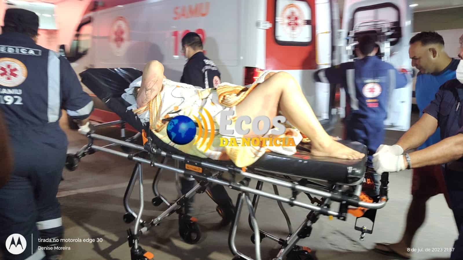 Colombiana que mora no Acre faz ritual com álcool e tem 70% do corpo queimado