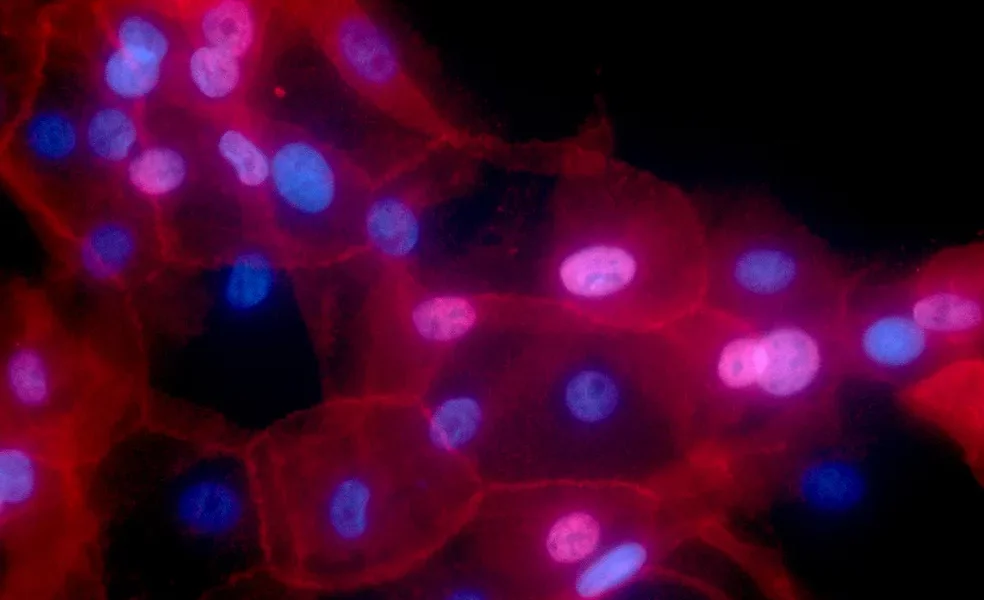 29730791700-45ca854b6e-o