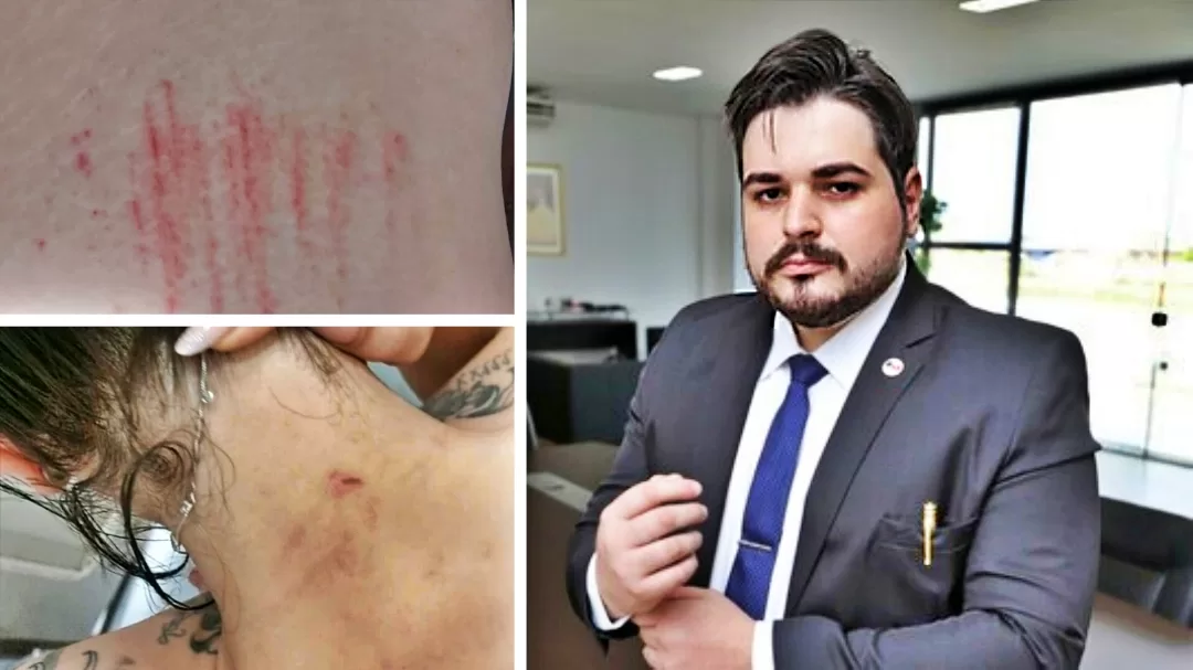 Empresária acusa advogado de agressão, ameaça e quebra de medida protetiva
