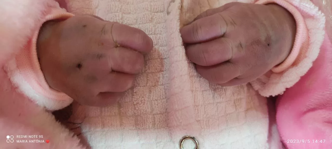 MP do Acre irá apurar morte de recém-nascida em Porto Walter