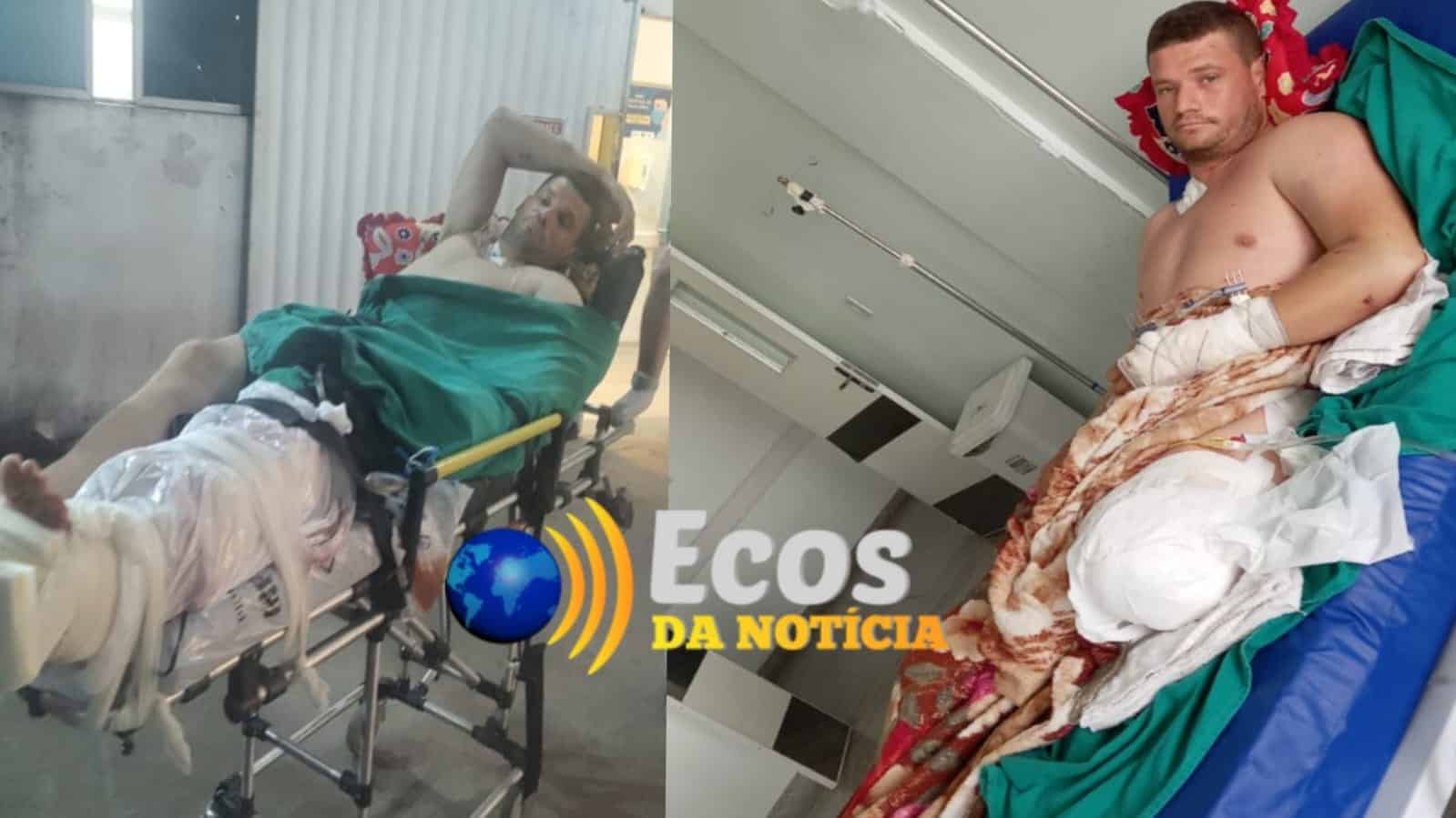 Homem tem perna amputada, após acidente de motocicleta